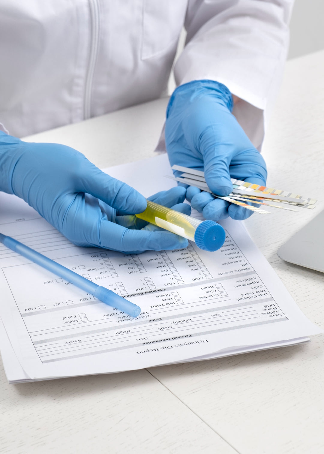 Lab doctor performing medical exam of urine